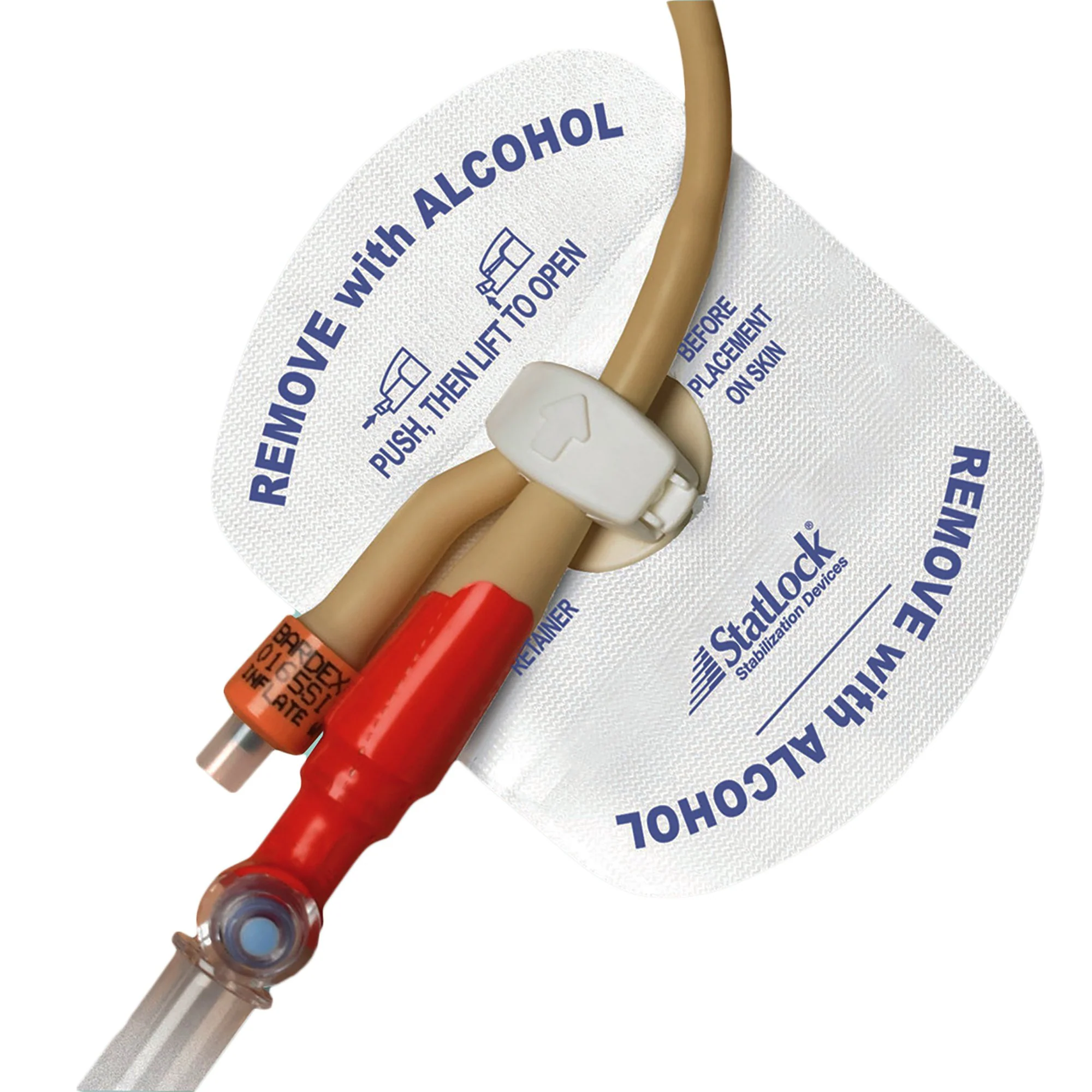 Statlock® Foley Stabilization Device - FOL0102 - Image 2